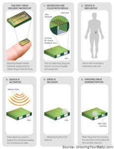 birth-control-microchip